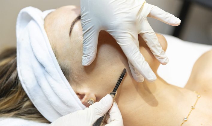 Dermaplaning Exfoliating Peach Fuzz Dermaplane Facial Shelton WA